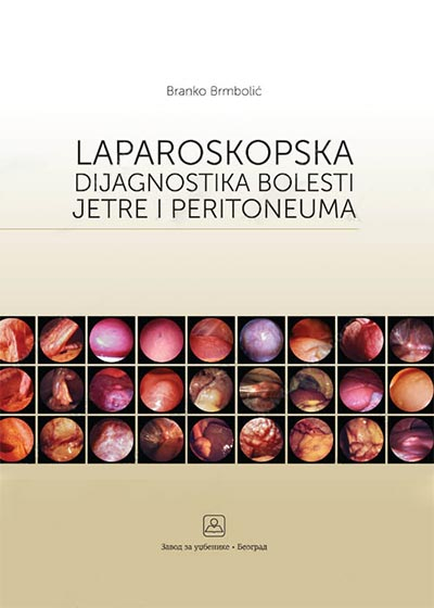 LAPAROSKOPSKA DIJAGNOSTIKA BOLESTI JETRE  I PERITONEUMA 