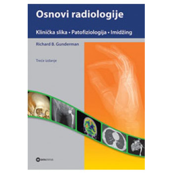 OSNOVI RADIOLOGIJE Klinička praksa patofiziologija imidžing III izdanje 