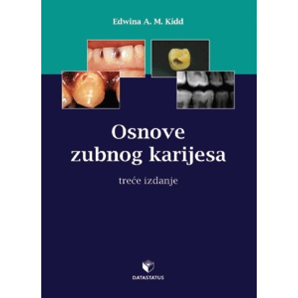 OSNOVI ZUBNOG KARIJESA 