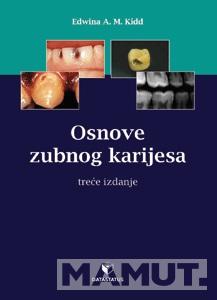 OSNOVI ZUBNOG KARIJESA 